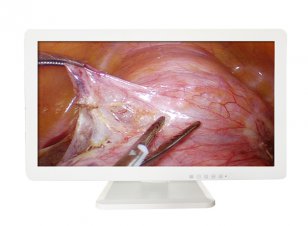 SY-M320 Endoscope 3D Monitor 32 inch